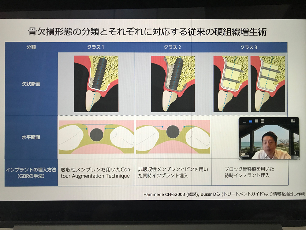 2021年度第5回日本臨床歯科学会福岡支部学術講演会